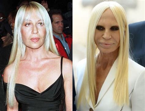 que le paso a donatella versace|donatella versace before and after.